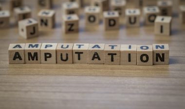 Amputation risk