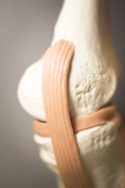 Knee joints meniscus tendons plastic