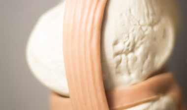 Knee joints meniscus tendons plastic