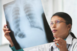 doctor checking chest xray image.