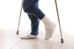 Young man with a broken ankle and a white leg cast with a sock to help keeping his toes warm, walking on crutches (isolated on white)