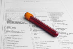 blood test