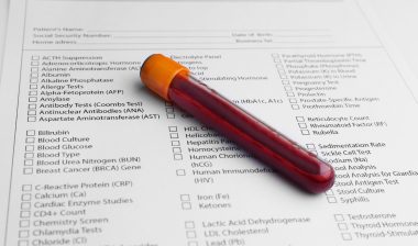 blood test