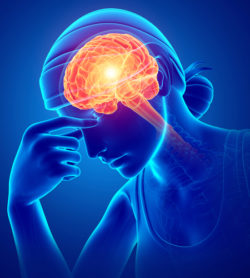 3d Illustration of Women Feeling Headache