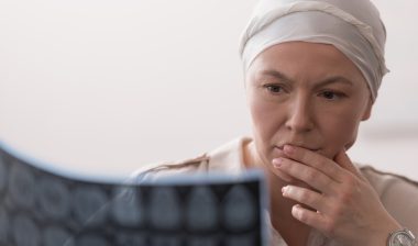 serious woman chemotherapy