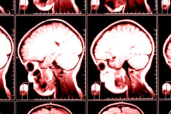 X-ray image of the brain computed tomography