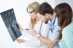 Zinbryta multiple sclerosis encephalitis brain inflammation doctors looking at brain CT scan