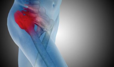 DePuy hip implant failure can lead to revision surgery