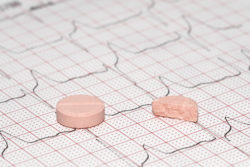 EKG looking at Uloric Cardiovascular Risks