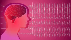 Long-term Dilantin Use Allegedly Linked to Cerebellar Atrophy Ataxia