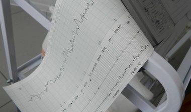 Side Effects of Onglyza may Include Heart Failure
