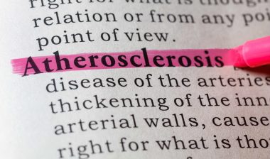 CML Treatment Drug Tasigna Linked with Atherosclerosis Risk