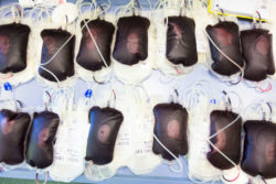 blood bags for transfusion needed from anticoagulant Xarelto problems