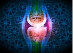 Exactech Knee Implant Components Might Wear Out or Contain Recalled Parts