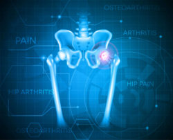 image of pelvis bones on blue background with red hip
