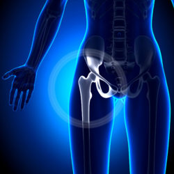 Injured Patients Seek Justice with LFIT V40 Stryker Lawsuit