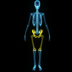 faulty hip replacements lead to Stryker LFIT complications