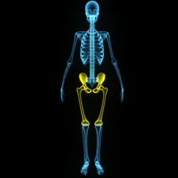 faulty hip replacements lead to Stryker LFIT complications