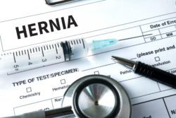 Woman Files Bard Hernia Mesh Lawsuit After Mother’s Death