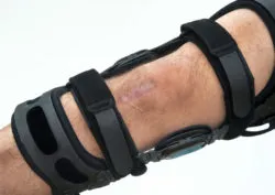 Lawyers Investigate Zimmer Tibial Plate Failure Claims