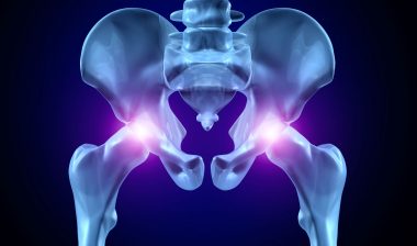 stryker-hip-replacement