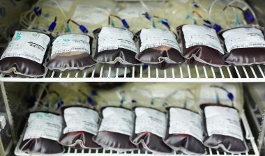Woman Files GI Bleed Lawsuit, Blames Xarelto Use