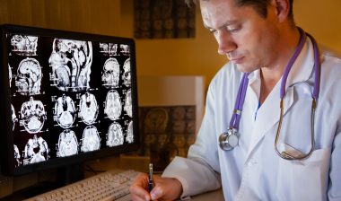 Dilantin adverse effects may include atrophy in the brain