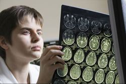 Multiple Sclerosis Patients May Suffer from Zinbryta Brain Inflammation