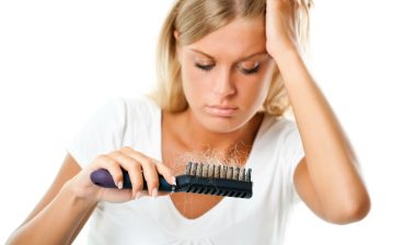 female-alopecia