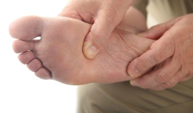Patients Allege Invokana Diabetic Amputations in Growing Litigation