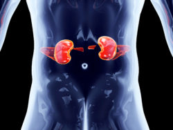 Chronic Kidney Disease Studies Show Possible Risk of Nexium Kidney Side Effects