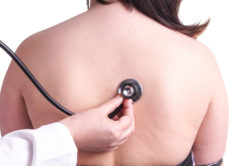 Causes of Lung Cancer Include Exposure to Asbestos