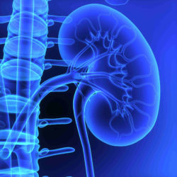 PPI and Kidney Problems Correlation alleged in Growing Nexium MDL