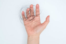 Woman Files Cancer Hair Loss Lawsuit After Suffering Permanent Hair Loss Injuries