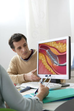 Tasigna side effects can include artheriosclerosis and other heart complications