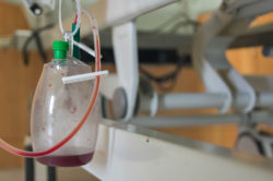 Inferior Vena Cava Filter Lawsuit Filed Over Gunther Tulip Device Complications