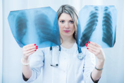 Reynolds Metals Faces Woman's Lung Cancer Asbestos Lawsuit in Federal Court