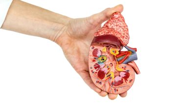 Growing Nexium MDL alleges Serious PPI Kidney Damage