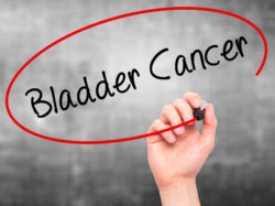 Potential Bladder Cancer and Diabetes Medication, Actos, Linked