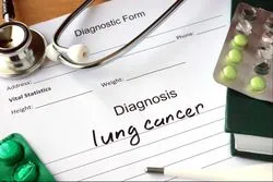 asbestos-lung-cancer-lawsuit
