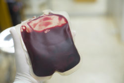 patients require infusions after Xarelto gastrointestinal bleeds