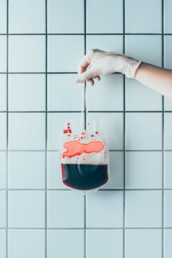 Pradaxa adverse side effects include bleeding risk