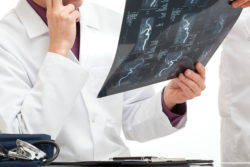 MRI patients can suffer gadolinium contrast side effects