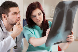 Have You Suffered from Asbestos Related Lung Cancer?