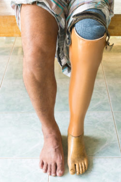 Patient Becomes Leg Amputee After Taking Diabetes Drug Invokana