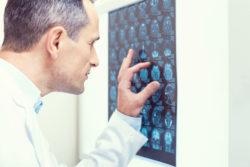 Gadolinium Retention Lawsuit Alleges MRI Contrast Agent Causes Tissue Damage
