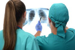 Exposure to Asbestos and Smoking Brought Together in Lung Cancer Trial