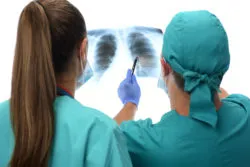 Exposure to Asbestos and Smoking Brought Together in Lung Cancer Trial