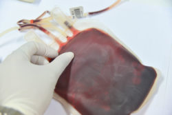 internal bleeding is a Xarelto side effect