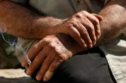 lung cancer causes include smoking and asbestos exposure